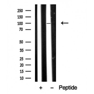 Western blot analysis of extracts of Human skeletal muscle? tissue sample,using DAG1 Antibody(DF10349).