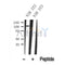 Western blot analysis of EPH B1/3/4 in lysates of NIH 3T3, using EPH B1/3/4 Antibody(DF10350).