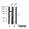Western blot analysis of FGFR1/2 in lysates of 293?, using FGFR1/2 Antibody(DF10351).