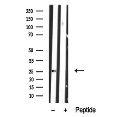 Western blot analysis of extracts of Human peripheral lymphocytes tissue sample,using LAB Antibody(DF10355).