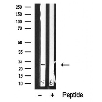 Western blot analysis of extracts of Human brain tissue sample,using NACA Antibody(DF10357).