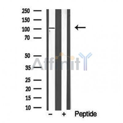Western blot analysis of PRK1/2 in lysates of Hela?, using PRK1/2 Antibody(DF10360).