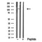 Western blot analysis of MER/TYRO3 in lysates of Hela?, using MER/TYRO3 Antibody(DF10363).