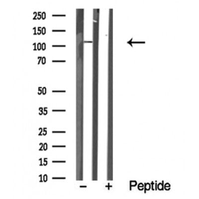 Western blot analysis of MER/TYRO3 in lysates of Hela?, using MER/TYRO3 Antibody(DF10363).