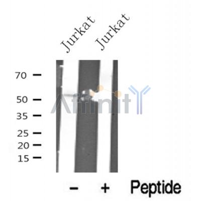 Western blot analysis of Smad1/9 in lysates of Jurkat?, using Smad1/9 Antibody(DF10365).