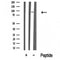Western blot analysis of RSK2 in lysates of HeLa , using RSK2 Antibody(DF10366).