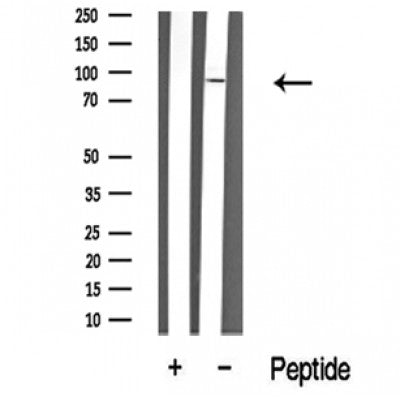 Western blot analysis of RSK2 in lysates of HeLa , using RSK2 Antibody(DF10366).