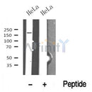 Western blot analysis of TOPBP1 in lysates of HeLa?, using TOPBP1 Antibody(DF10369).