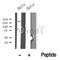 Western blot analysis of TOPBP1 in lysates of HeLa?, using TOPBP1 Antibody(DF10369).