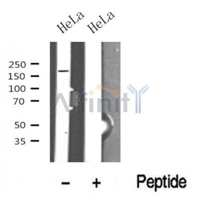 Western blot analysis of TOPBP1 in lysates of HeLa?, using TOPBP1 Antibody(DF10369).