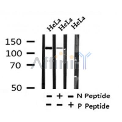 Western blot analysis of Phospho-PER2(Ser662) in lysates of HeLa?, using Phospho-PER2(Ser662) Antibody(AF4301).