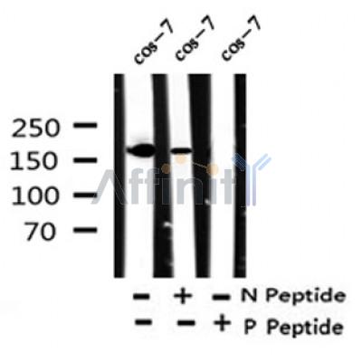 Western blot analysis of Phospho-ROCK1(Tyr913) in lysates of cos-7, using Phospho-ROCK1(Tyr913) Antibody(AF4303).