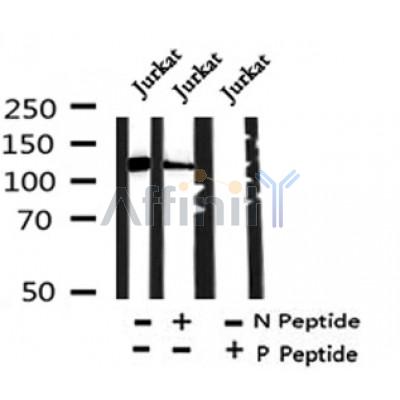 Western blot analysis of Phospho-ASPP2 (Ser698) in lysates of Jurkat?, using Phospho-ASPP2 (Ser698) Antibody(AF4319).