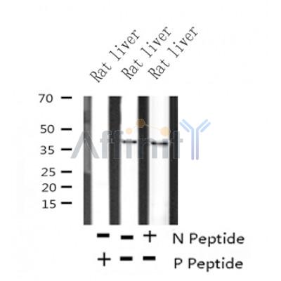 Western blot analysis of Phospho-GRAP2(Thr262) in lysates of Rat liver?, using Phospho-GRAP2(Thr262) Antibody(AF4322).