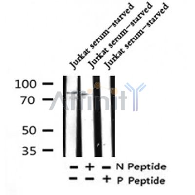 Western blot analysis of Phospho-SLP76(Tyr173) in lysates of Jurkat serum-starved , using Phospho-SLP76(Tyr173) Antibody(AF4324).