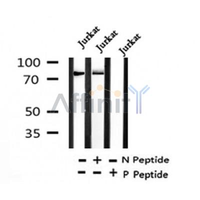 Western blot analysis of Phospho-P2X7(Ser390) in lysates of Jurkat?, using Phospho-P2X7(Ser390) Antibody(AF4326).