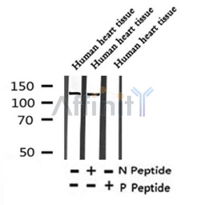 Western blot analysis of Phospho-APAF(Ser320) in lysates of Human heart tissue, using Phospho-APAF(Ser320) Antibody(AF4333).