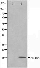 Western blot analysis on HeLa cell lysate using p15 INK Antibody. The lane on the left is treated with the antigen-specific peptide.