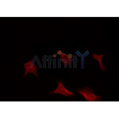 AF0230 staining HeLa by IF/ICC. The sample were fixed with PFA and permeabilized in 0.1% Triton X-100,then blocked in 10% serum for 45 minutes at 25¡ãC. The primary antibody was diluted at 1/200 and incubated with the sample for 1 hour at 37¡ãC. An  Alexa Fluor 594 conjugated goat anti-rabbit IgG (H+L) Ab, diluted at 1/600, was used as the secondary antibod