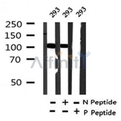 Western blot analysis of Phospho-CYLD(Ser422) in lysates of 293?, using Phospho-CYLD(Ser422) Antibody(AF4337).