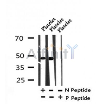 Western blot analysis of Phospho-PAR1(Tyr420) in lysates of Platelet, using Phospho-PAR1(Tyr420) Antibody(AF4344).
