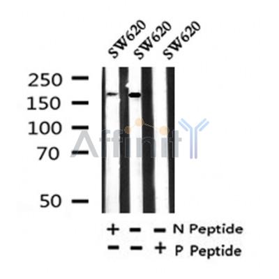 Western blot analysis of Phospho-LRP5(Tyr1473) in lysates of SW620, using Phospho-LRP5(Tyr1473) Antibody(AF4345).