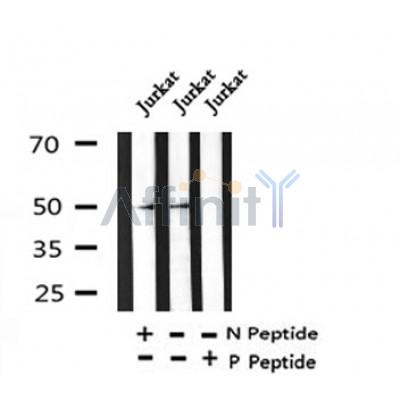 Western blot analysis of Phospho-NAKED2(Tyr247) in lysates of Jurkat, using Phospho-NAKED2(Tyr247) Antibody(AF4347).
