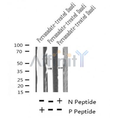 Western blot analysis of Phospho-CD32(Tyr288) in lysates of Pervanadate-treated Daudi?, using Phospho-CD32(Tyr288) Antibody(AF4348).