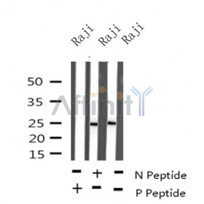 Western blot analysis of Phospho-CD79B(Tyr207) in lysates of Raji?, using Phospho-CD79B(Tyr207) Antibody(AF4349).