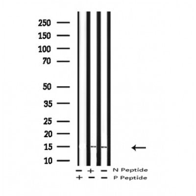 Western blot analysis of Phospho-LC3B(Thr29) in lysates of  hela overnight  chloroquine (50 uM), using Phospho-LC3B(Thr29) Antibody(AF4350).