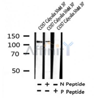Western blot analysis of Phospho-ATP citrate lyase(Ser455/457) in lysates of COS7 Calyculin 50nM 30', using Phospho-ATP citrate lyase(Ser455/457) Antibody(AF4368).