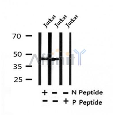Western blot analysis of Phospho-eIF4A2(Tyr49) in lysates of Jurkat, using Phospho-eIF4A2(Tyr49) Antibody(AF4373).