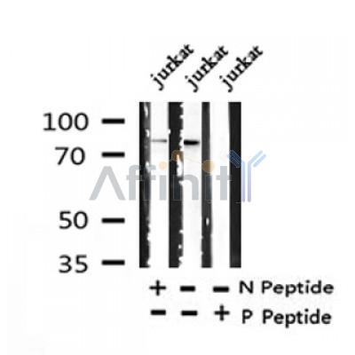 Western blot analysis of Phospho-TrkA (Tyr785) /TrkB (Tyr816) in lysates of jurkat?, using Phospho-TrkA (Tyr785) /TrkB (Tyr816) Antibody(AF4390).