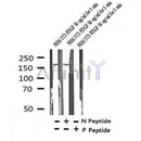 Western blot analysis of Phospho-PDGF Receptor beta (Tyr751) in lysates of NIH/3T3 PDGF 50 ng/ml for 5 min, using Phospho-PDGF Receptor beta (Tyr751) Antibody(AF4398).