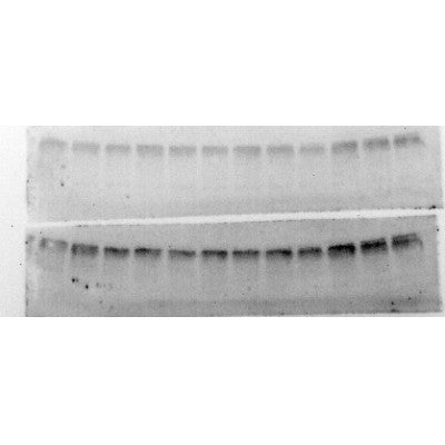 AF3309 staining HeLa  cells by IF/ICC. The sample were fixed with PFA and permeabilized in 0.1% Triton X-100,then blocked in 10% serum for 45 minutes at 25¡ãC. The primary antibody was diluted at 1/200 and incubated with the sample for 1 hour at 37¡ãC. An  Alexa Fluor 594 conjugated goat anti-rabbit IgG (H+L) antibody(Cat.