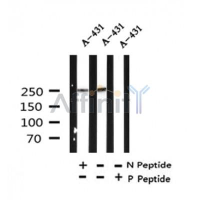 Western blot analysis of Phospho-Desmoplakin (Ser165/166) in lysates of A-431, using Phospho-Desmoplakin (Ser165/166) Antibody(AF4409).