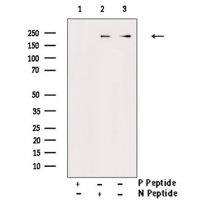Western blot analysis of Phospho-mTOR (Thr2446) Antibody expression in Insulin treated NIH-3T3 cells lysates.The lane on the right is treated with the antigen-specific peptide.