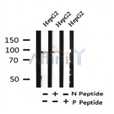 Western blot analysis of Phospho-IREB1 (Ser138) in lysates of HepG2, using Phospho-IREB1 (Ser138) Antibody(AF4411).