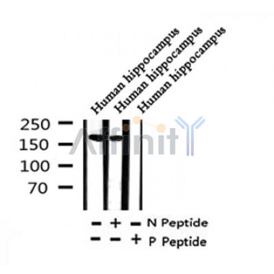 Western blot analysis of Phospho-Ras-GRF1 (Ser927) in lysates of Human hippocampus, using Phospho-Ras-GRF1 (Ser927) Antibody(AF4414).