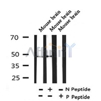 Western blot analysis of Phospho-OPRM1 (Ser375) in lysates of Mouse brain, using Phospho-OPRM1 (Ser375) Antibody(AF4420).