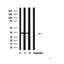 AF3311 staining Hela by IF/ICC. The sample were fixed with PFA and permeabilized in 0.1% Triton X-100,then blocked in 10% serum for 45 minutes at 25¡ãC. The primary antibody was diluted at 1/200 and incubated with the sample for 1 hour at 37¡ãC. An  Alexa Fluor 594 conjugated goat anti-rabbit IgG (H+L) Ab, diluted at 1/600, was used as the secondary antibod