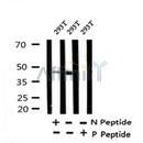 Western blot analysis of Phospho-RAD52 (Tyr104) in lysates of 293T?, using Phospho-RAD52 (Tyr104) Antibody(AF4431).