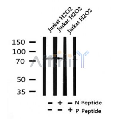 Western blot analysis of Phospho-Syk (Tyr352) in lysates of Jurkat? H2O2, using Phospho-Syk (Tyr352) Antibody(AF4432).