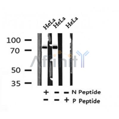 Western blot analysis of Phospho-Numb (Ser276) in lysates of HeLa?, using Phospho-Numb (Ser276) Antibody(AF4435).