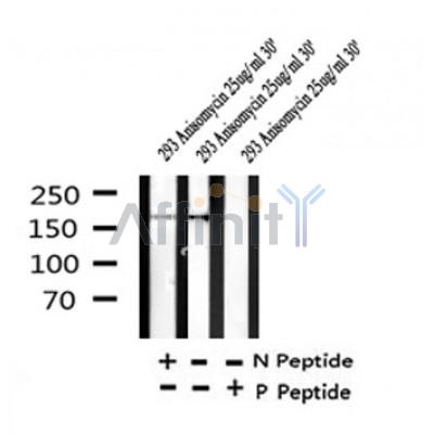 Western blot analysis of Phospho-Tuberin/TSC2 (Ser664) (D3B9Z) in lysates of 293 Anisomycin 25ug/ml 30', using Phospho-Tuberin/TSC2 (Ser664) (D3B9Z) Antibody(AF4437).