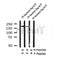Western blot analysis of Phospho-Tuberin/TSC2 (Tyr1571) in lysates of 293 Anisomycin 25ug/ml 30', using Phospho-Tuberin/TSC2 (Tyr1571) Antibody(AF4438).