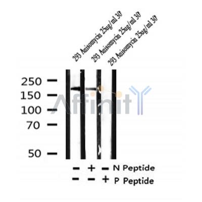 Western blot analysis of Phospho-Tuberin/TSC2 (Tyr1571) in lysates of 293 Anisomycin 25ug/ml 30', using Phospho-Tuberin/TSC2 (Tyr1571) Antibody(AF4438).