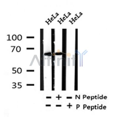Western blot analysis of Phospho-IRAK1 (Thr100) in lysates of HeLa?, using Phospho-IRAK1 (Thr100) Antibody(AF4441).