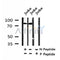 Western blot analysis of Phospho-Etk (Tyr40) in lysates of Jurkat?, using Phospho-Etk (Tyr40) Antibody(AF4444).