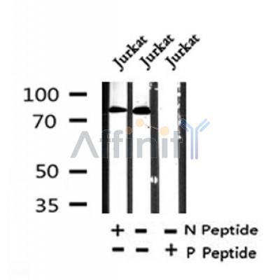 Western blot analysis of Phospho-Etk (Tyr40) in lysates of Jurkat?, using Phospho-Etk (Tyr40) Antibody(AF4444).